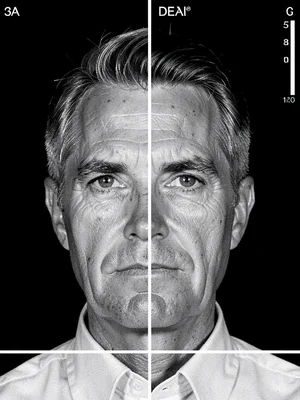 Medical scan portrait, MRI slices recombined with photograph