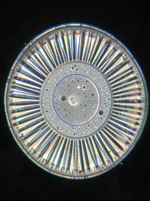 A thin section of a kidney stone in cross-polarized light — concentric birefring