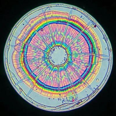 A synthetic polymer film crystallization — concentric banding pattern in birefri
