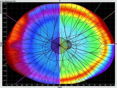 Full object showing complete stress map