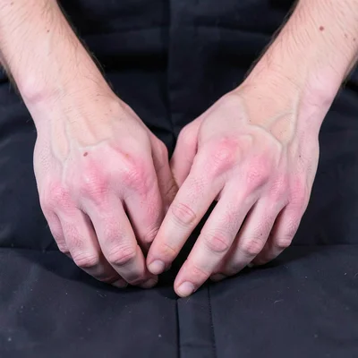 Hands solarized