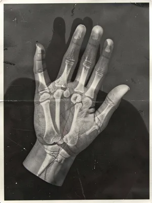 A photogram of a human hand — bones and soft tissue as layered transparency