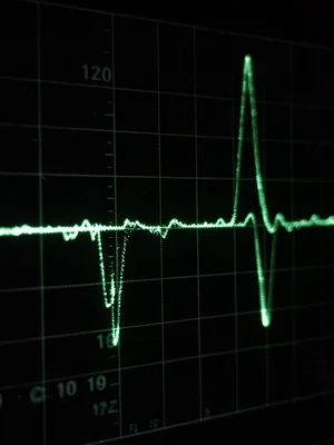 Square Wave Rise Time Detail